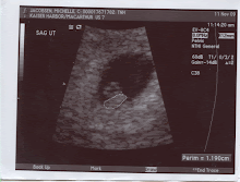 Cade's 6 Week Ultrasound