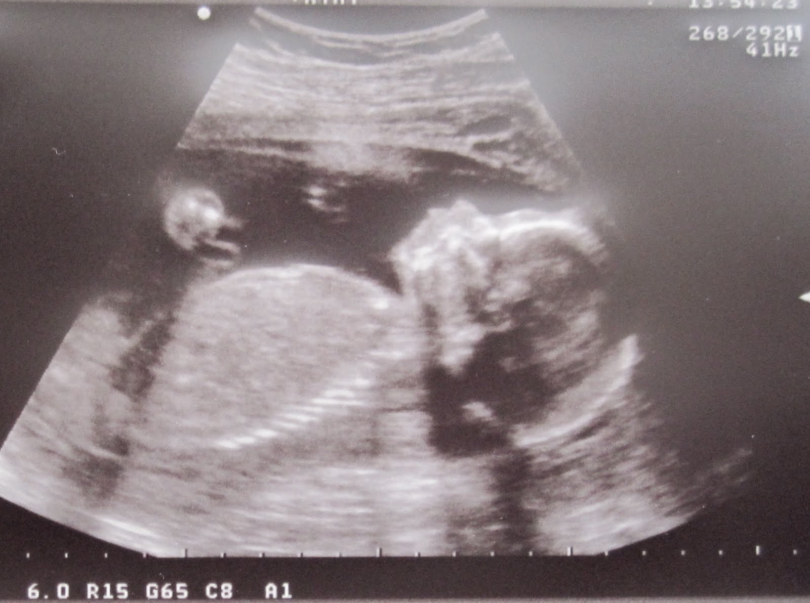 cats with passports: anatomy scan at 21 weeks 1 day