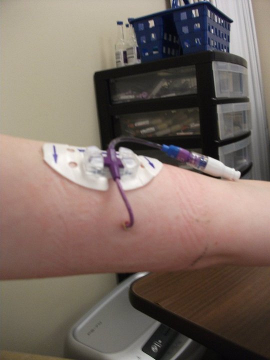 My Fight Against Lyme Disease: PICC Line