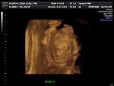 Baby A 3D at 18 weeks