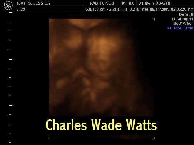 Hello from the womb