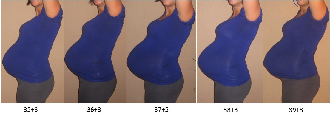 40 Ssw Harter Bauch Aber Keine Schmerzen Isn Ding wa??: Bauchbild 40. SSW