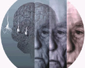 Aportes de la Psicosomatica Psicoanalitica a la comprension de la conducta corporal del demente