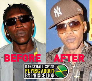 vybz+kartel+bleaching+cake+soap+after+before+dancehall+news.jpg