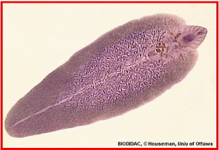 Emberi fascioliasis tünetei