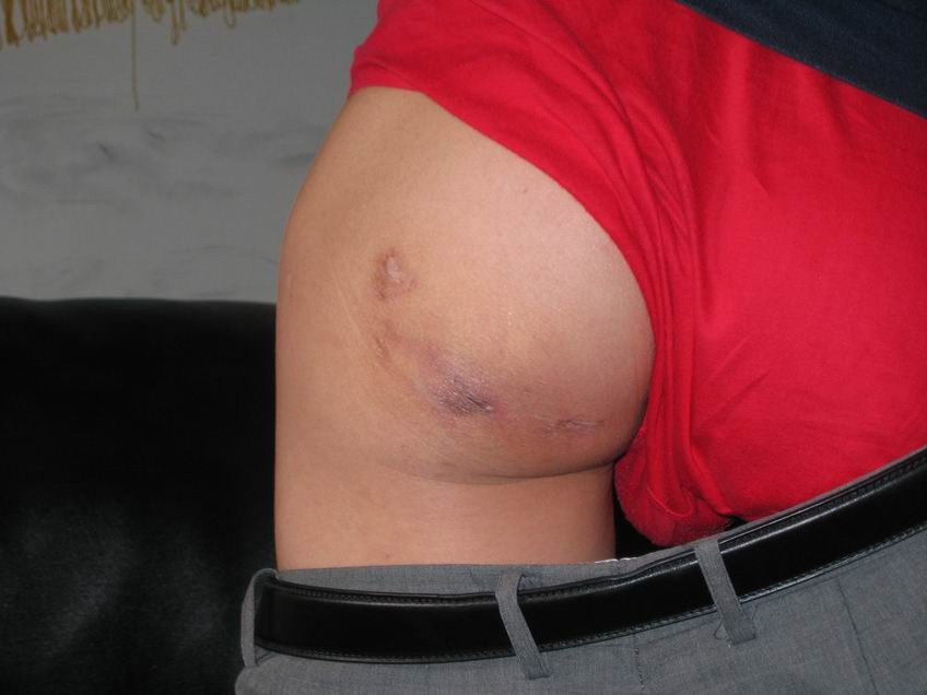 [è°ƒæ•´å¤§å°+æœæ·ç”Ÿçš„ä¼¤æƒ…ç…§ç‰‡+006.jpg]