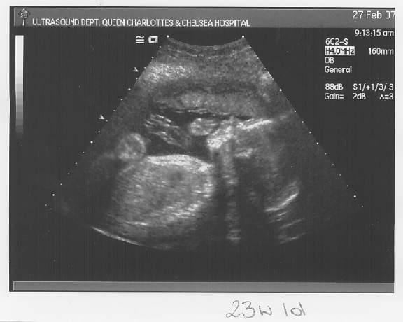 [scan3_3.jpg]