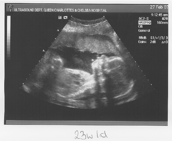 [scan3_1.jpg]