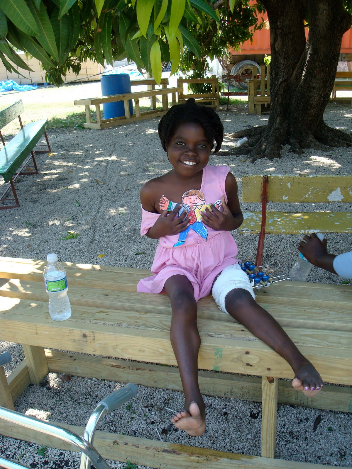 Physical Therapy Haiti Relief Starting Therapy