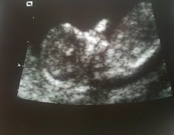 Baby at 12 month sonogram