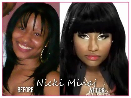 nicki minaj before and after plastic surgery. Nicki Minaj Before And After