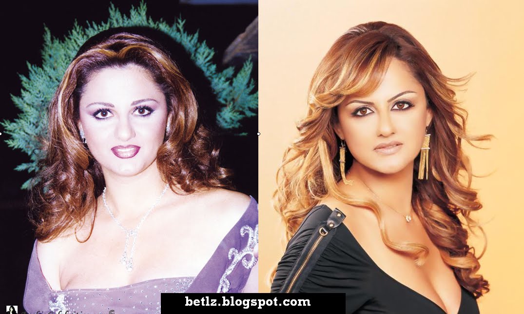 Lebanese Girls the Most Beautiful or Lebanese Doctors the Most Skilled