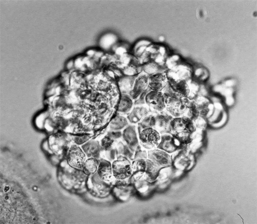 [Human-blastocyst.gif]