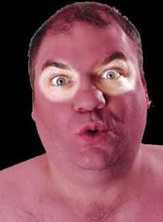 [071006_sunburn.jpg]