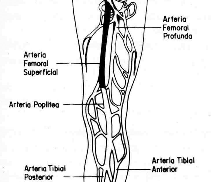 Pierna la obstruida arteria derecha en
