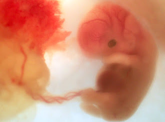 Black Dog Star: Strings, Strands & the Sound of Music