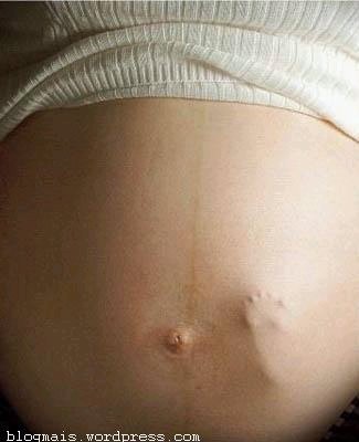 [barriga+e+pÃ©.bmp]