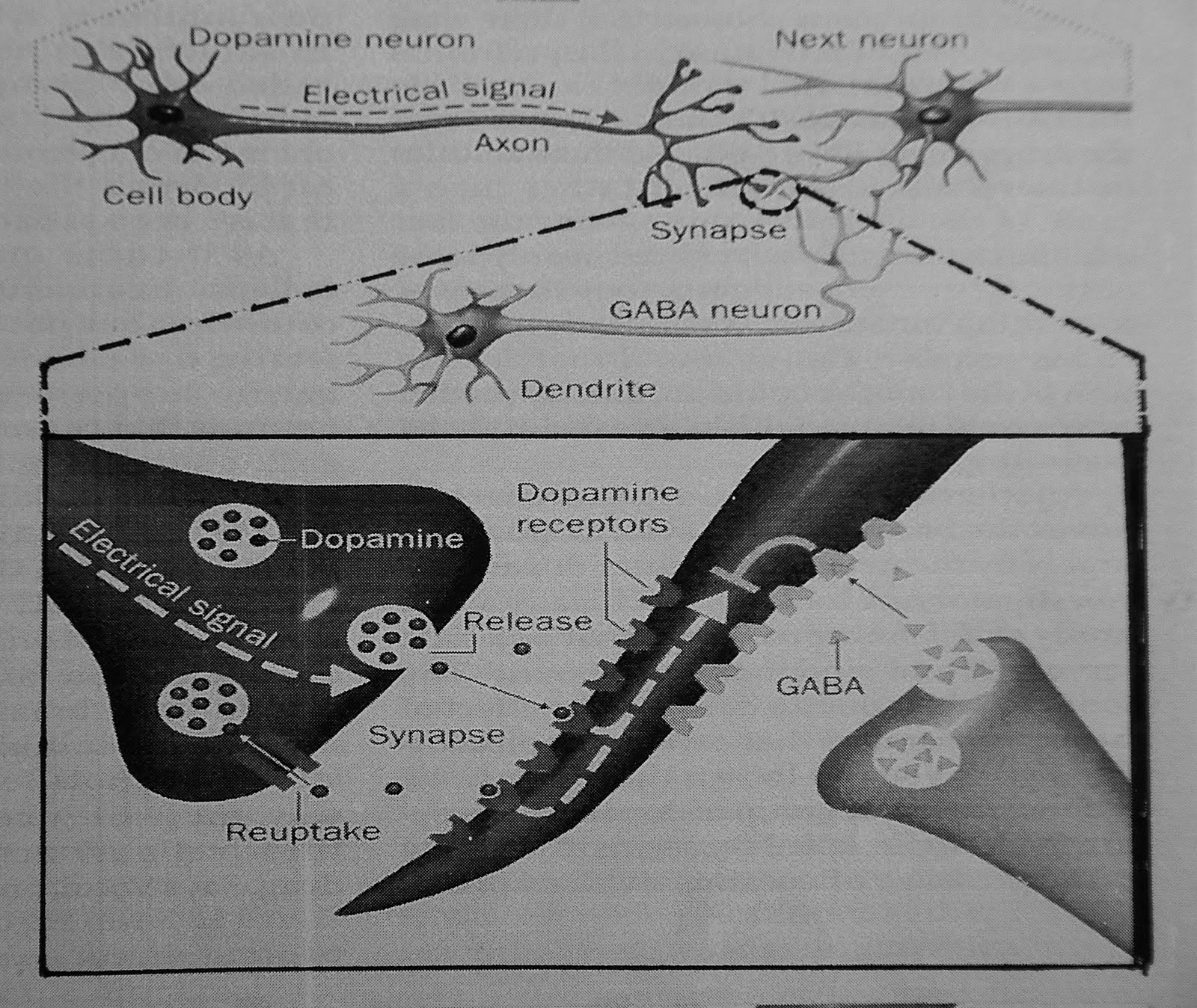 Stutter-Mind-Body: Stuttering and Neurotransmitters