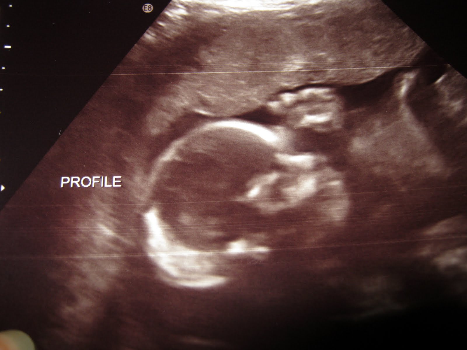 Sprinkled with Blessings from Above 24 week ultrasound pics
