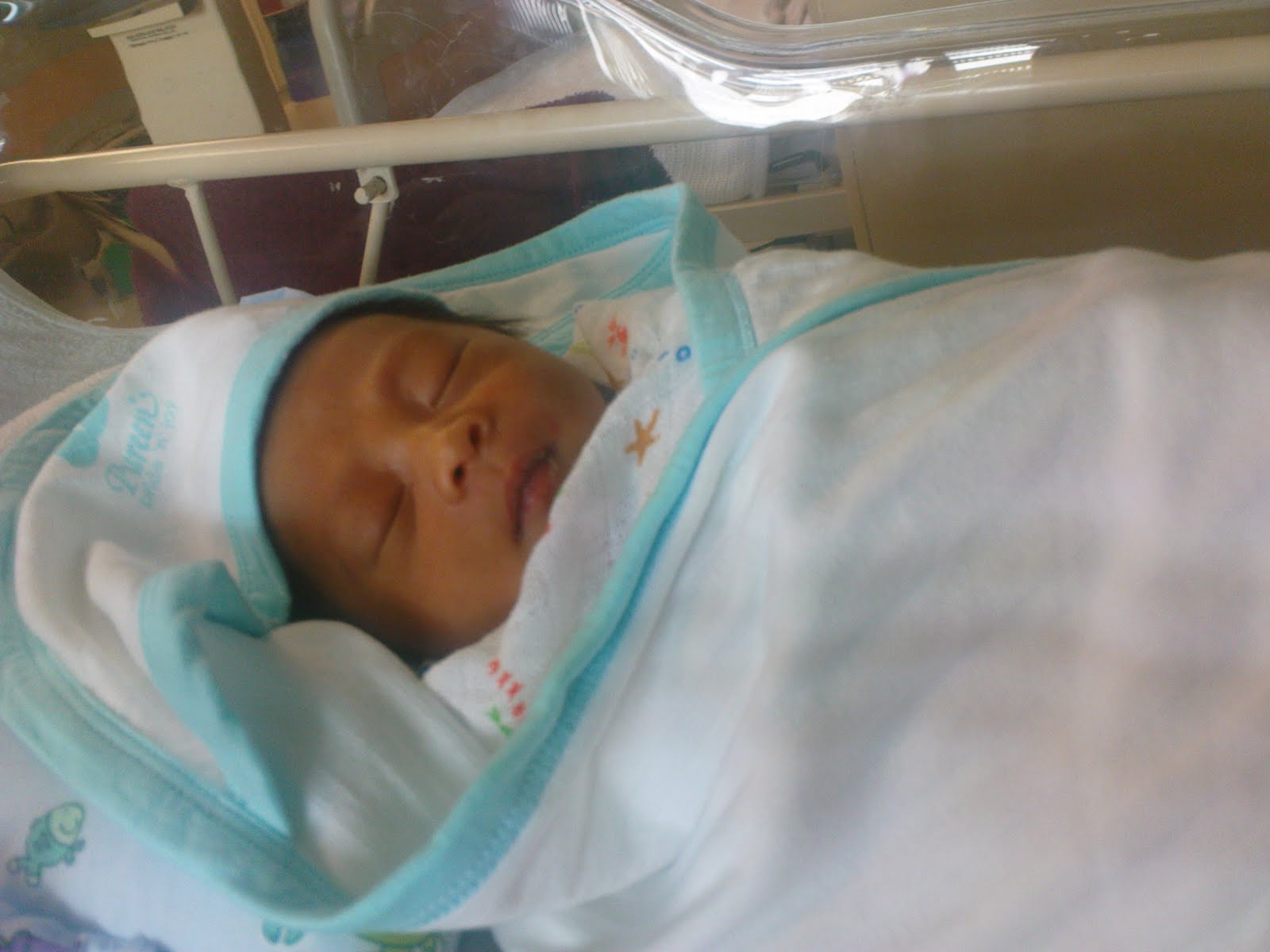 IT'S ABOUT US Jaundice