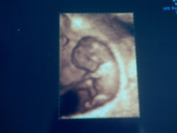 9 Week U/S