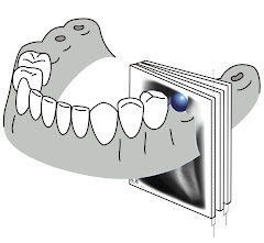 Esquemas de cortes Radiograficos en Maxilar
