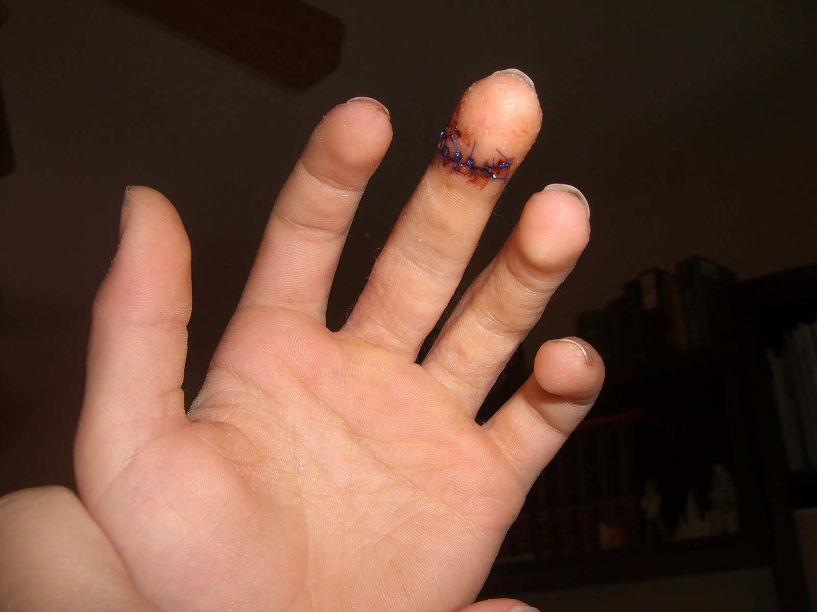 What's cookin in the kitchen he cut his finger