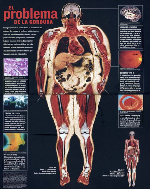 nutraleo EL PROBLEMA DE LA GORDURA nutraleo EL PROBLEMA DE LA GORDURA