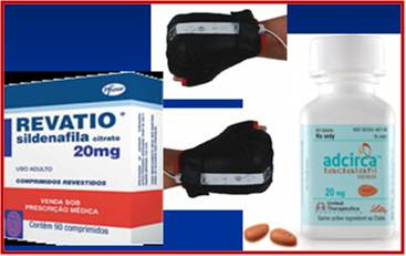 Stromectol tablets buy Stromectol tablets buy