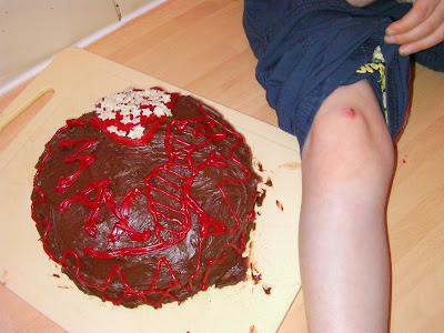 home cake decoration chocolate stars and contusions on leg