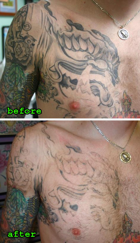 wrecking balm tattoo removal