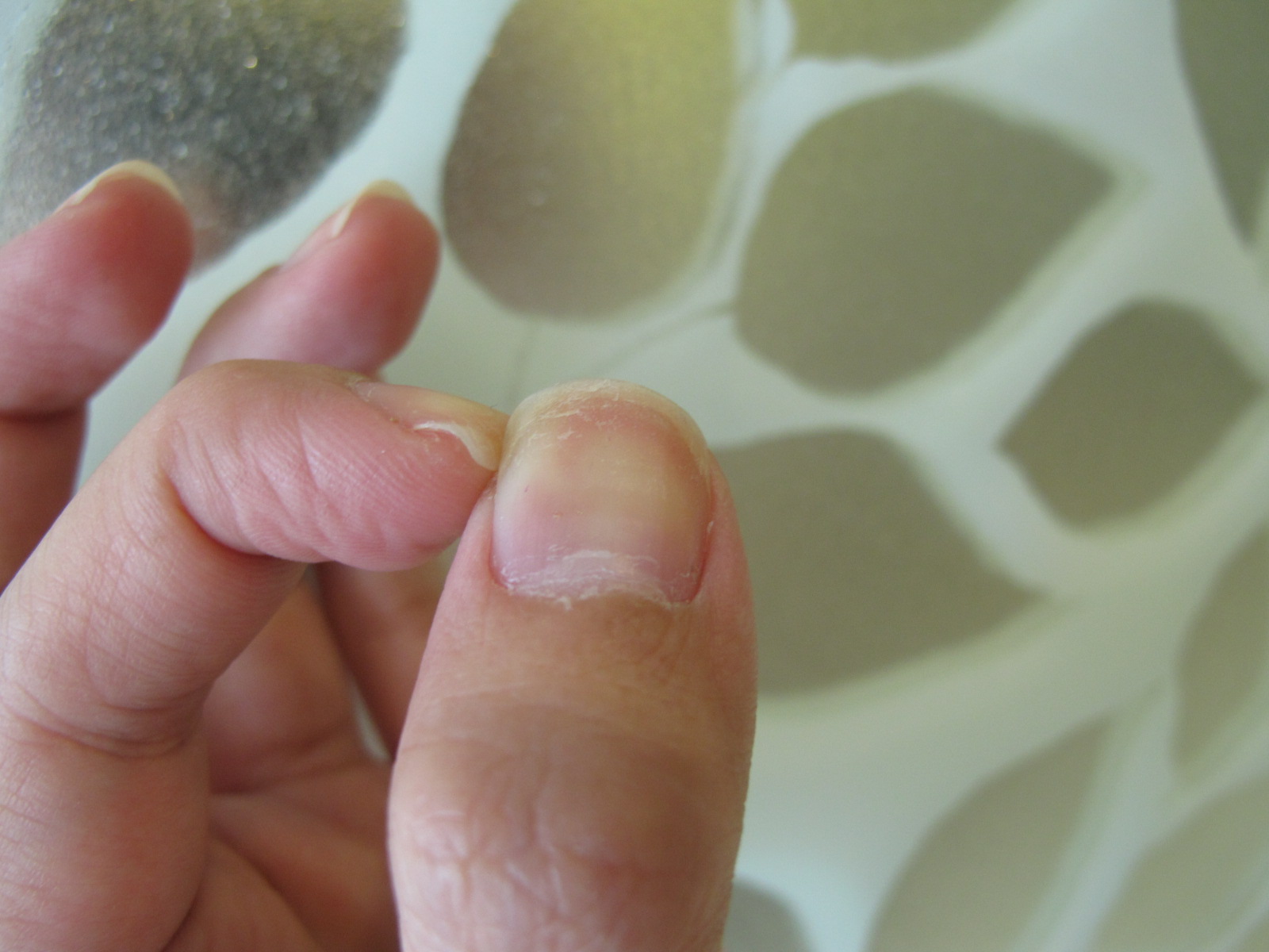 Beauty Gossipologyst Soft and Peeling Nails *Yikes* NAILTEK Hydartion Therapy II