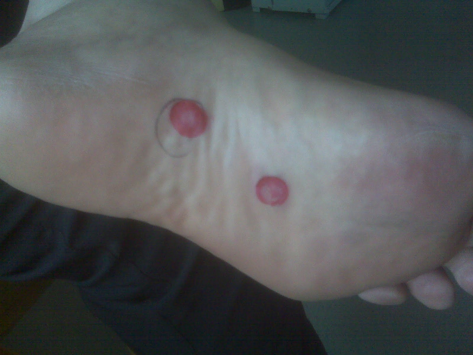 Dr Richard Blake Podiatry Blog Foot And Ankle Problems On Feedspot