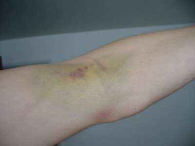 plasma donating after dangers days darker later person lot