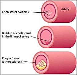 Best Natural Medicine To Lower Cholesterol Best Natural Medicine To Lower Cholesterol