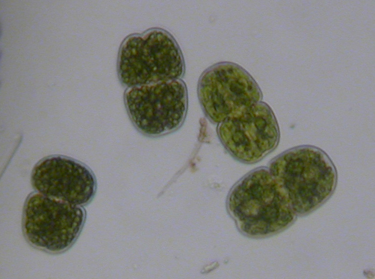 Squirrel's View: Plants and other green stuff in the pond sample