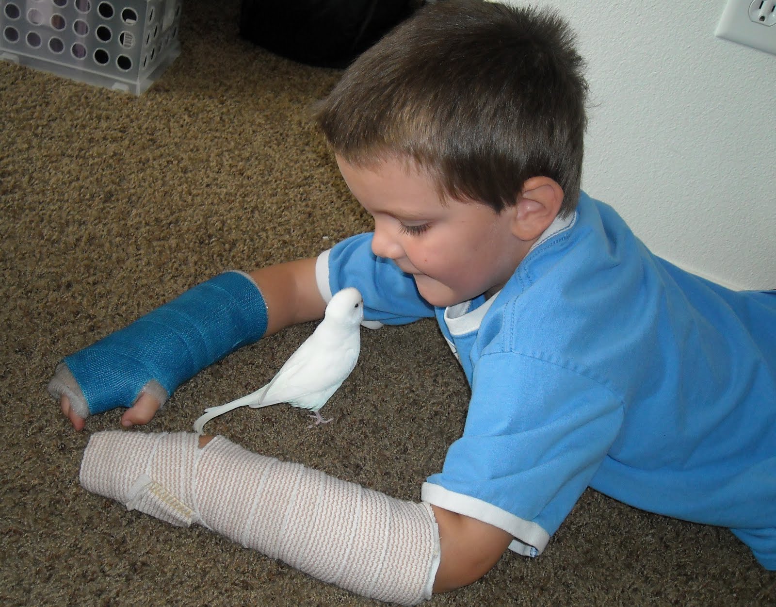 Strange Run of Luck Two Broken Arms