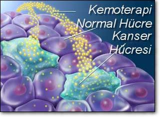[Kanser+tedavisinde+kemoterapi.jpg]
