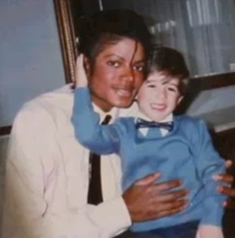 [MJ+vitiligo+6.jpg]