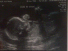 Baby Emmel Week 20