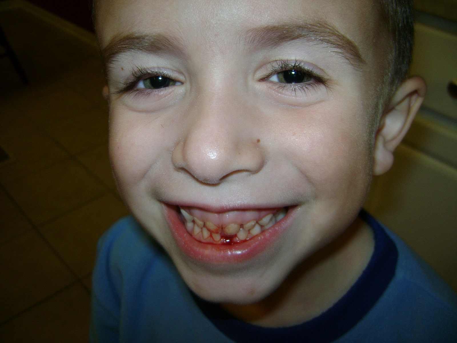 Embracing Life's Journeys His First Tooth Came Out...