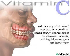 Vitamin C deficit
