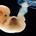 What is a human embryo? Answers, please, by 10 March ...