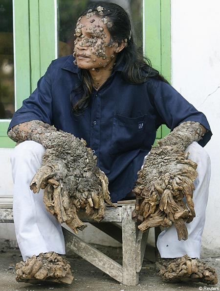[tree-man.jpg]