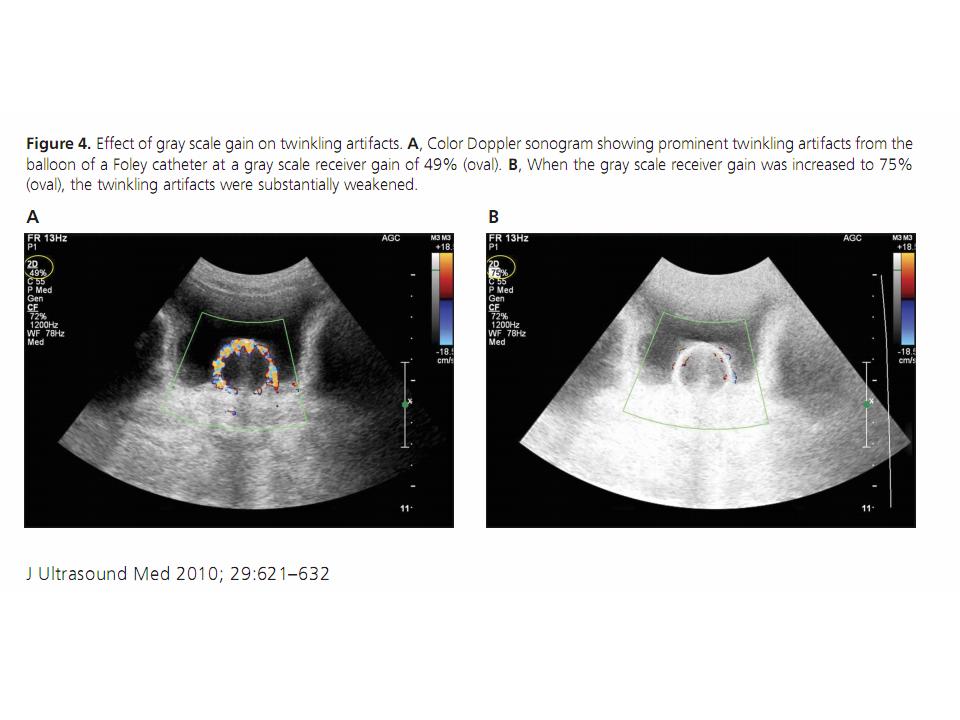 BÀI SOẠN VỀ SIÊU ÂM CHẨN ĐOÁN: TWINKLING ARTIFACTS, USEFUL SONOGRAPHIC ...