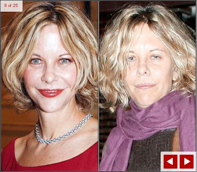 Celebrity Dirt with Jackson Blue: Celebrities who look like crap