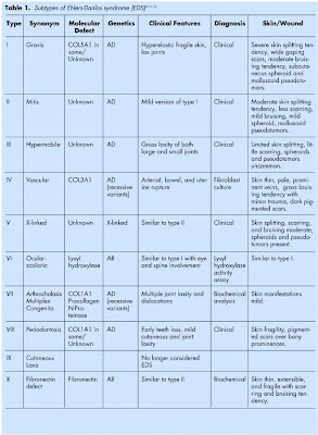 Pin on my style aortic aneurysm: Ehler-Danlos Syndrome- I am wayyyyyy too flexible.