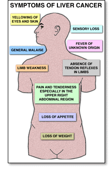what causes liver cancer in men what causes liver cancer in men