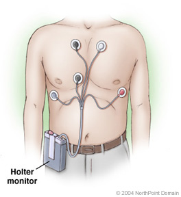 [Holter_Monitor.jpg]