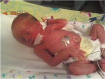 Benjamin 1 Week